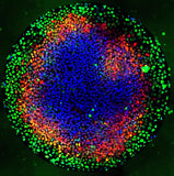 Human Embryonic Stem Cells